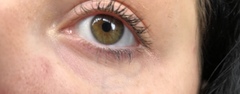 Feel really down about my skin. Pics included