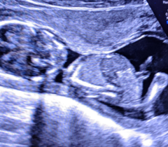 September 2018 Babies - Thread #3