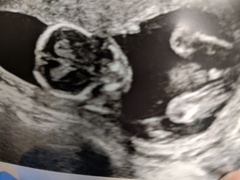 September 2018 Babies - Thread #3
