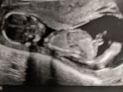 September 2018 Babies - Thread #3