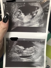 Boy or girl? Loads of pics