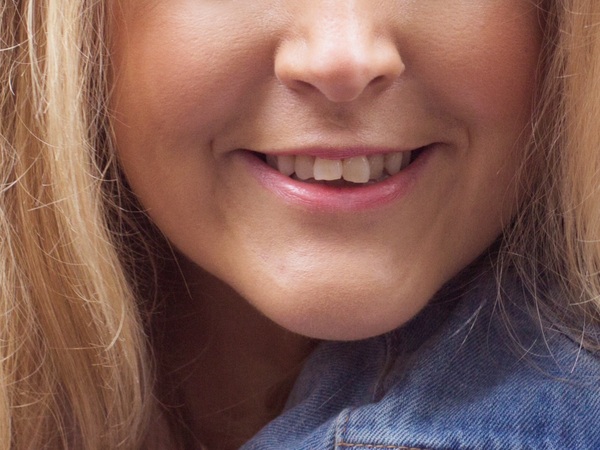Do these teeth need fixed? Pic included, am probably mad!