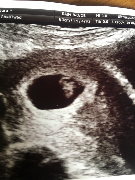 December 2018 babies