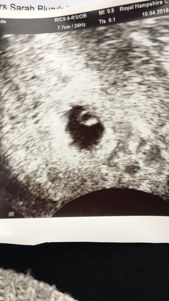 December 2018 babies