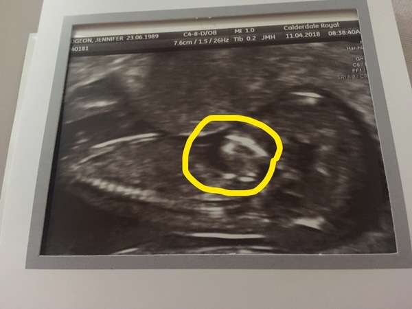 What's this?