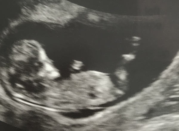 Blurry scan but any guesses ?