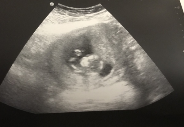 Baby’s gender
