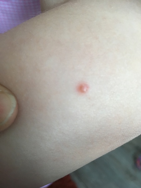 Strange spot on arm. What is it?