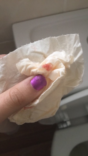 Could this be implantation bleeding?