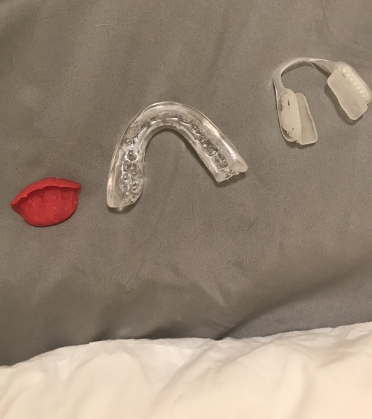 Root canal in front teeth? Can anyone help, please?