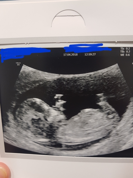 Another gender guess