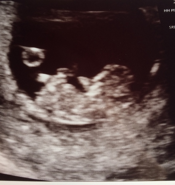 Boy or girl? Just for fun!