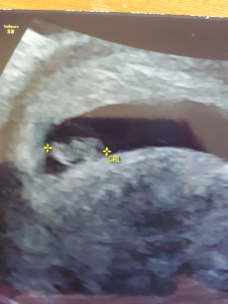 December 2018 babies