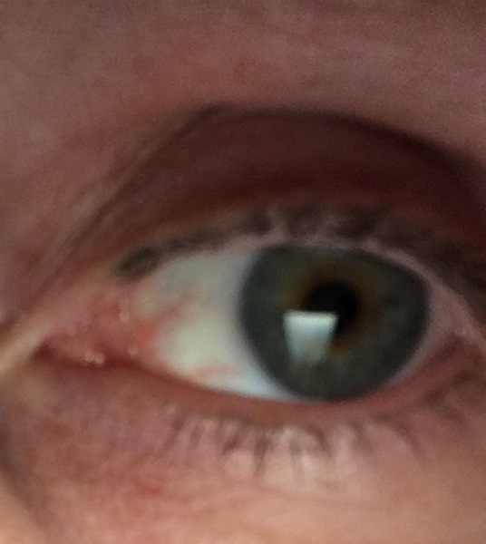 Anyone had semi-permanent eyeliner and willing to share your pics!!