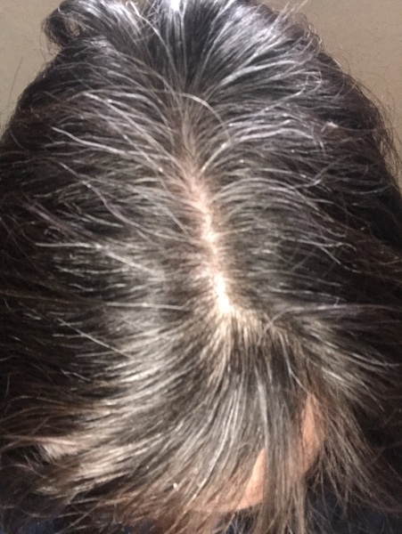 To grow out my grey in early 30s?