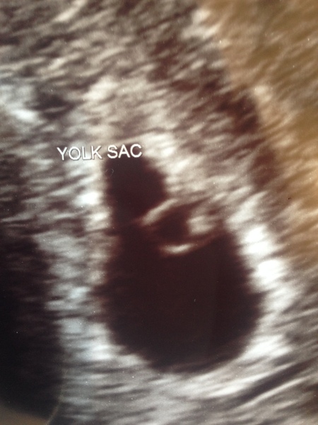 December 2018 babies