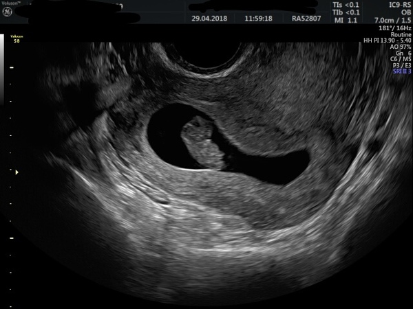 First Pregnancies with Nov/Dec Due dates?