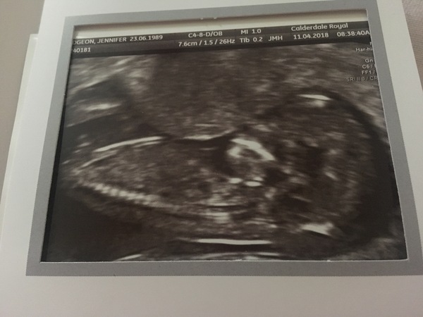 Had my scan - any gender guesses?