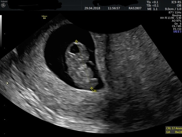 First Pregnancies with Nov/Dec Due dates?