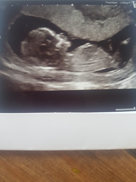 Boy or girl