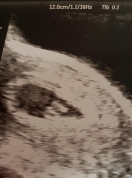 First Pregnancies with Nov/Dec Due dates?