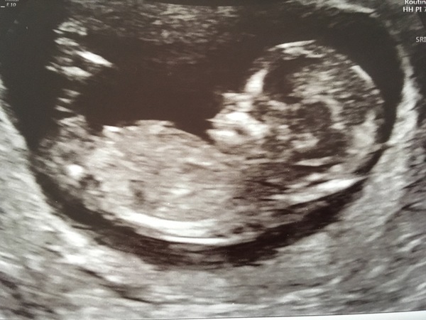 Anyone due in October?