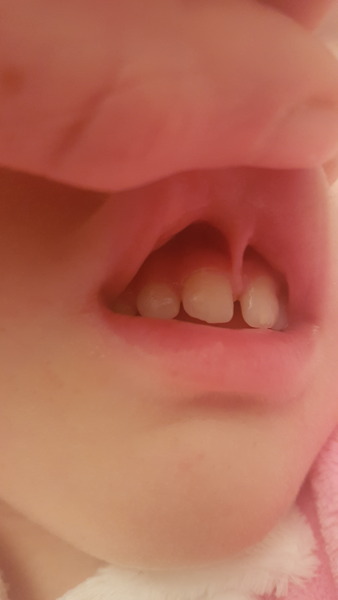 Mouth and teeth