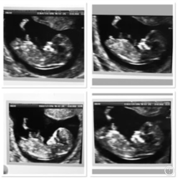 Any gender guesses please?