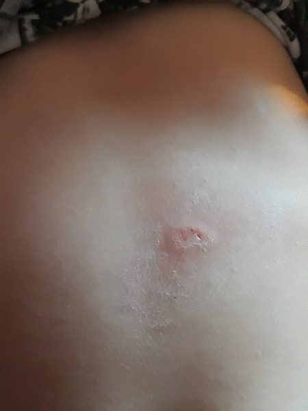 To think I'm being lied to WRT this injury