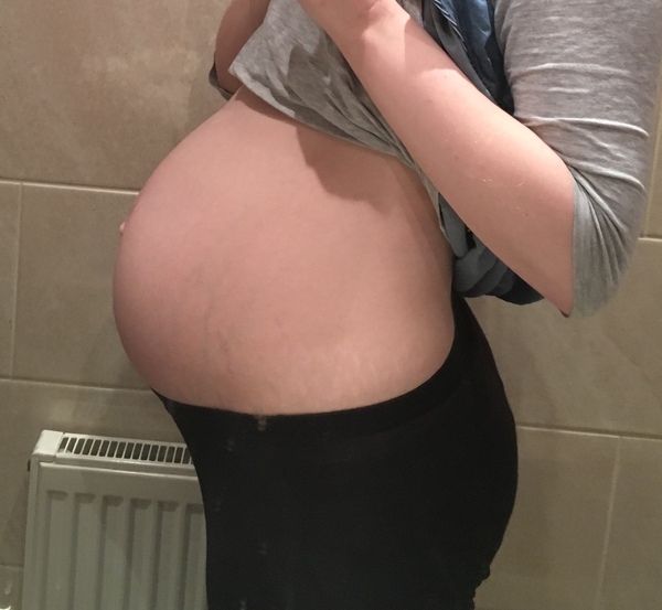 Baby bumps