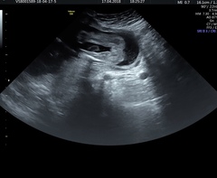 16 weeks told boy, 21 weeks told girl. Who to believe?