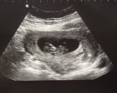 Baby’s gender