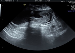 16 weeks told boy, 21 weeks told girl. Who to believe?