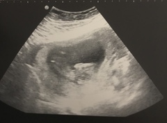Baby’s gender