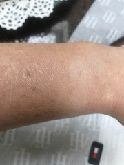 🐌 Fantastic Skincare: The One Where Sallie Swallows Dermaplaned a Lion Named Fabio