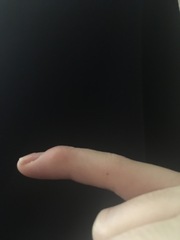 To go to A&E for a broken finger?