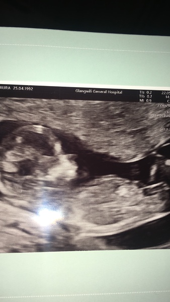 Boy or girl? Nub theory for fun.