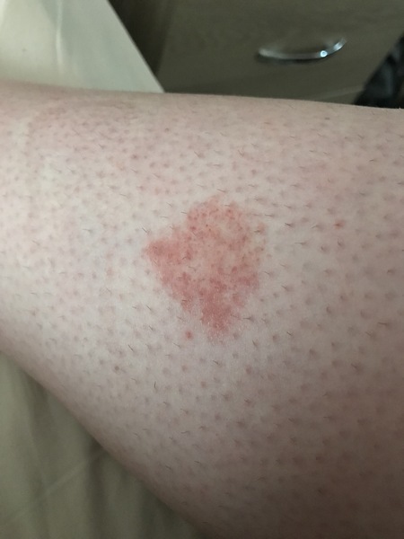 Anyone know what this could be?