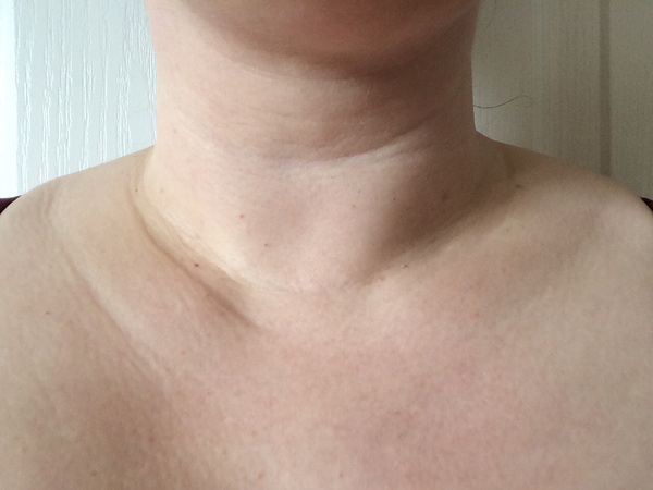 What can I do to improve my décolletage? (With photo)