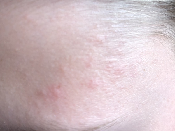 Advice please - Cleanser for a 12yr old boy