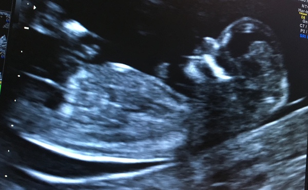 First Pregnancies with Nov/Dec Due dates?