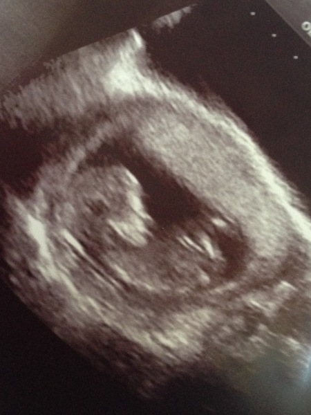 First Pregnancies with Nov/Dec Due dates?