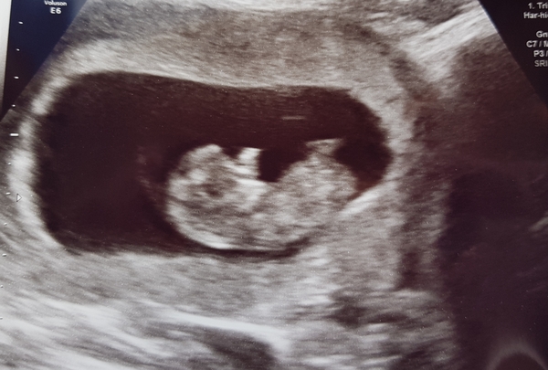 December 2018 Babies - Thread #2