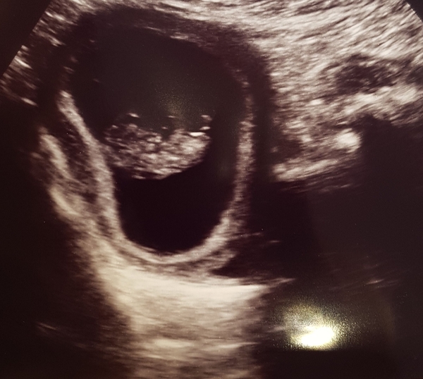 December 2018 Babies - Thread #2