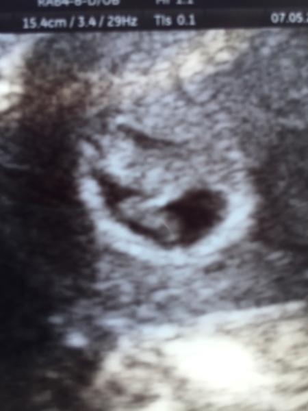 December 2018 Babies - Thread #2