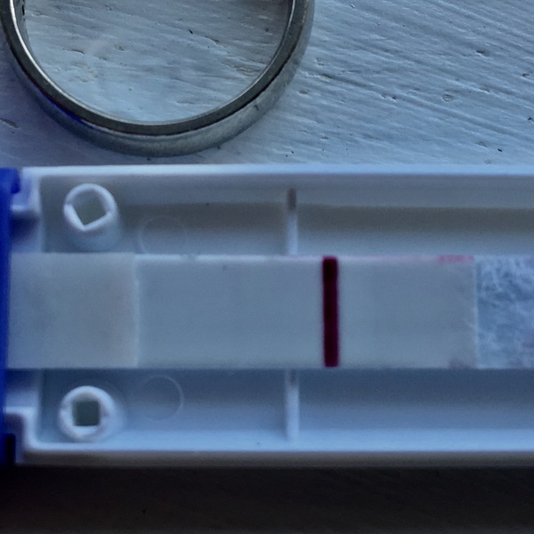 Line eyes ? Preg post erpc