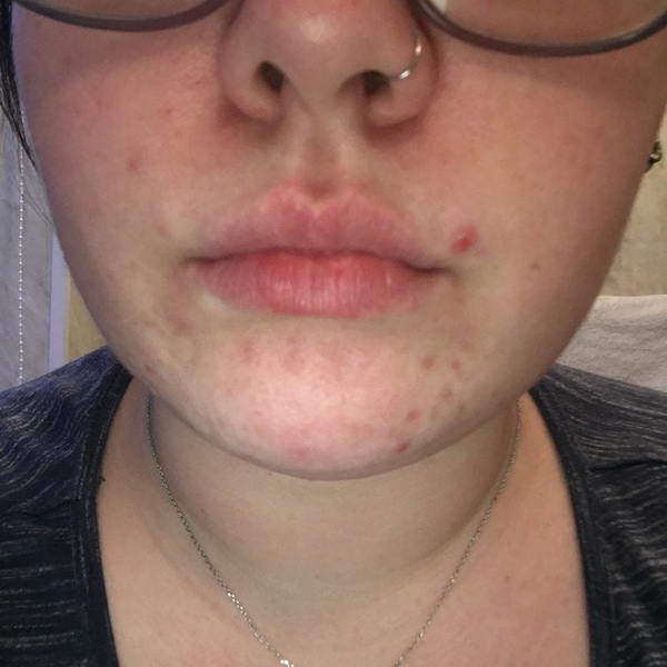 Help me with my awful skin please!