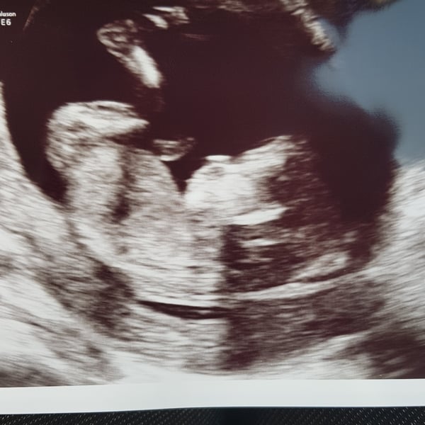 Baby gender