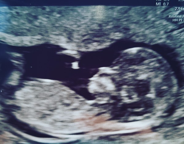 December 2018 Babies - Thread #2