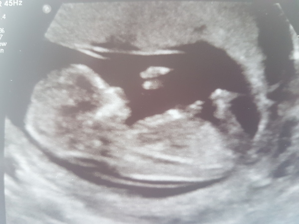 Just for fun - boy or girl?!